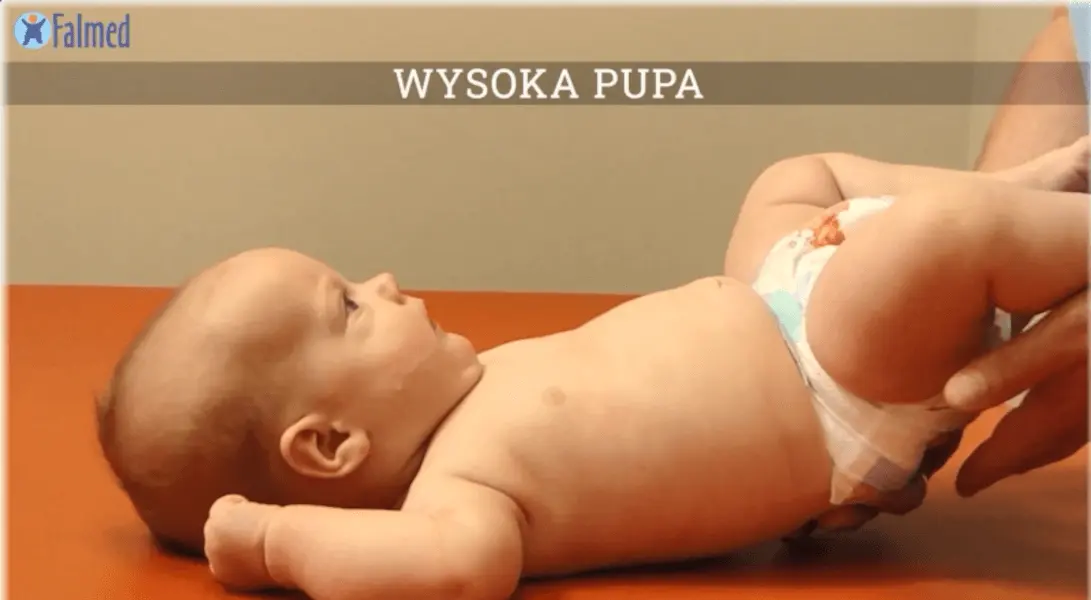 wysoka-pupa